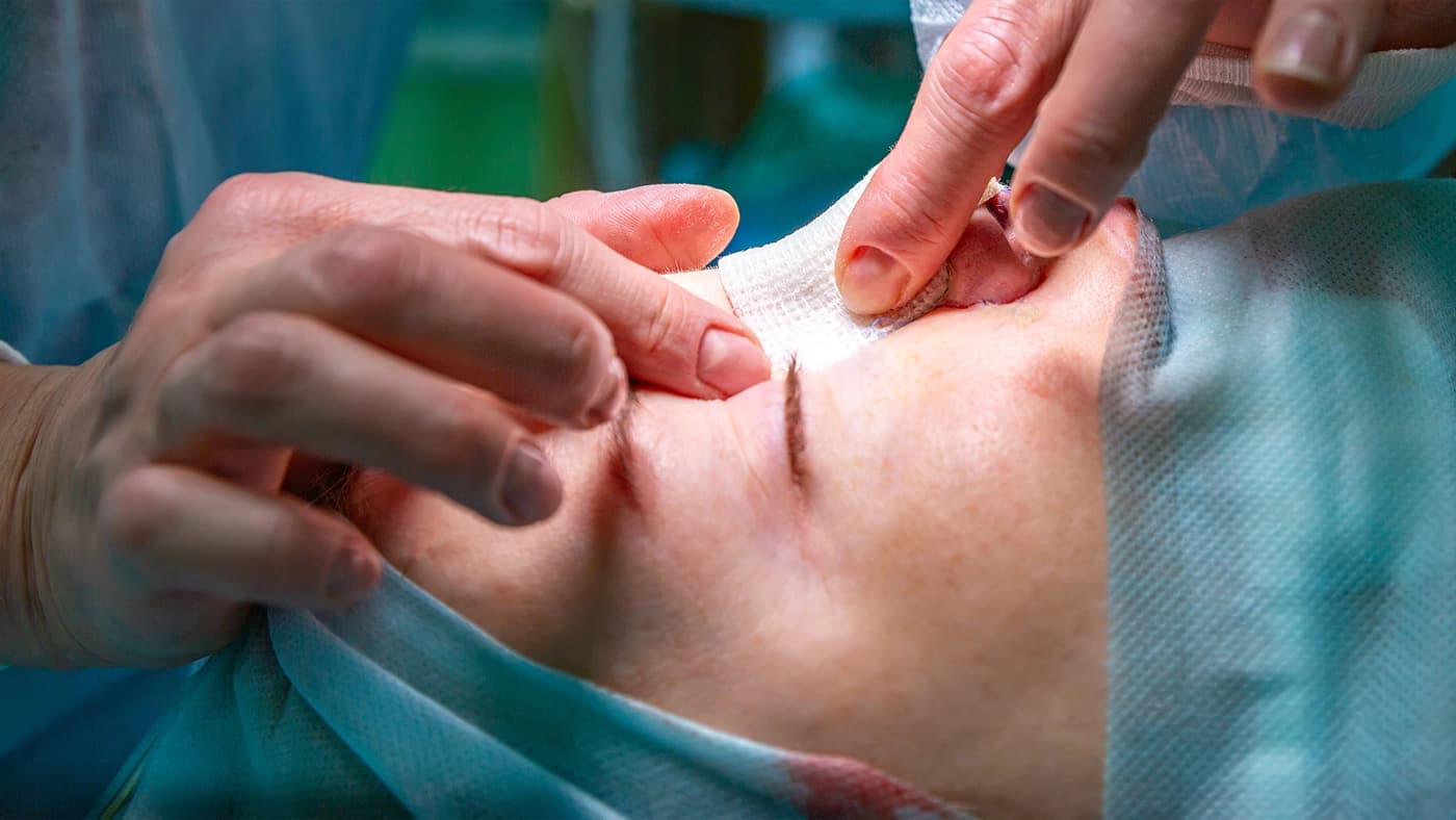 A detailed guide to rhinoplasty, featuring a professional photo of a surgeon performing a nose surgery, highlighting various rhinoplasty techniques and recovery insights.